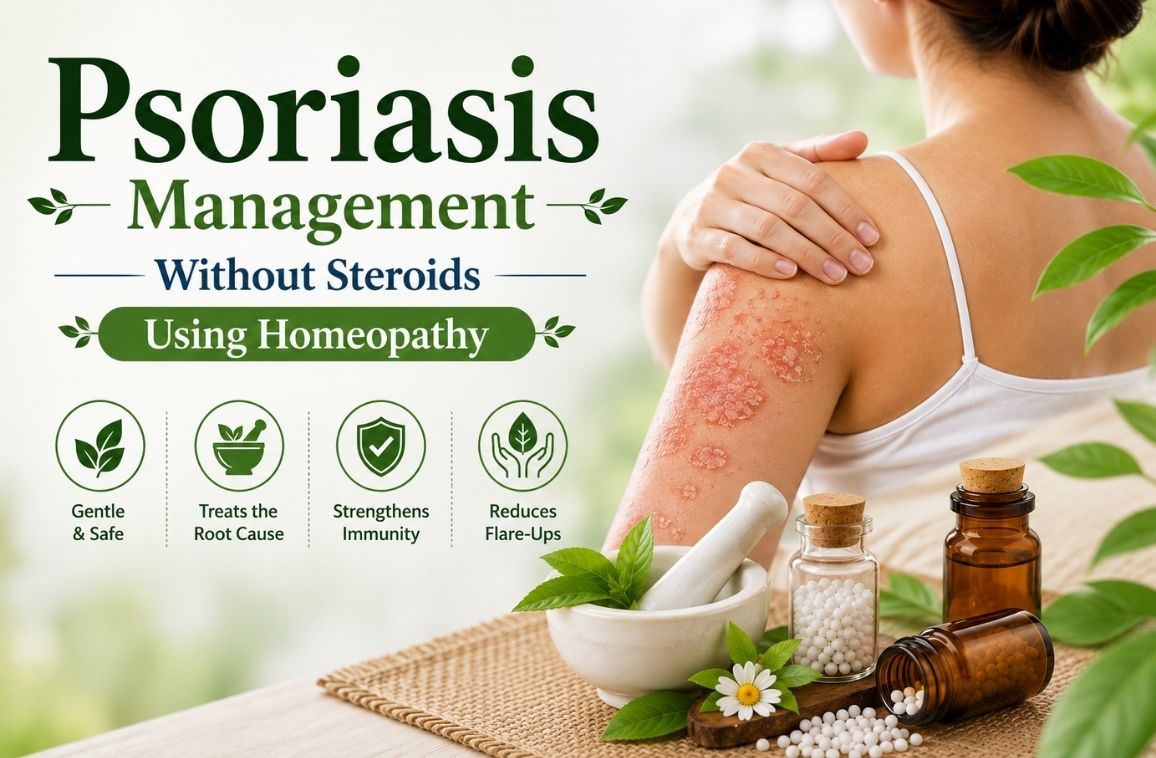 Psoriasis Management Without Steroids Using Homeopathy